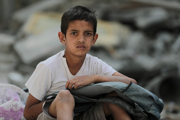 Gazze’den 12 hasta çocuk Mısır ve Ürdün’e tahliye edildi