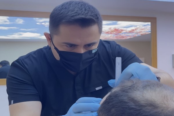 Uzmanı açıkladı: “Saç ekimi işlemleri, yenilikçi teknolojiyle artık daha kısa sürüyor”