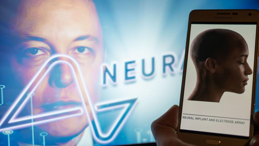 Elon Musk, kendisine ait Neuralink şirketinin ilk kez bir insanın beynine çip yerleştirdiğini duyurdu