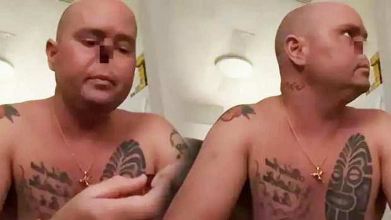 Grip sonrası burnunu tamamen kaybetti