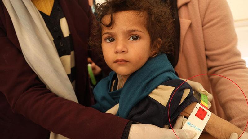UNICEF: Gazzeli çocuklar yetersiz besleniyor, hayatları tehlikede
