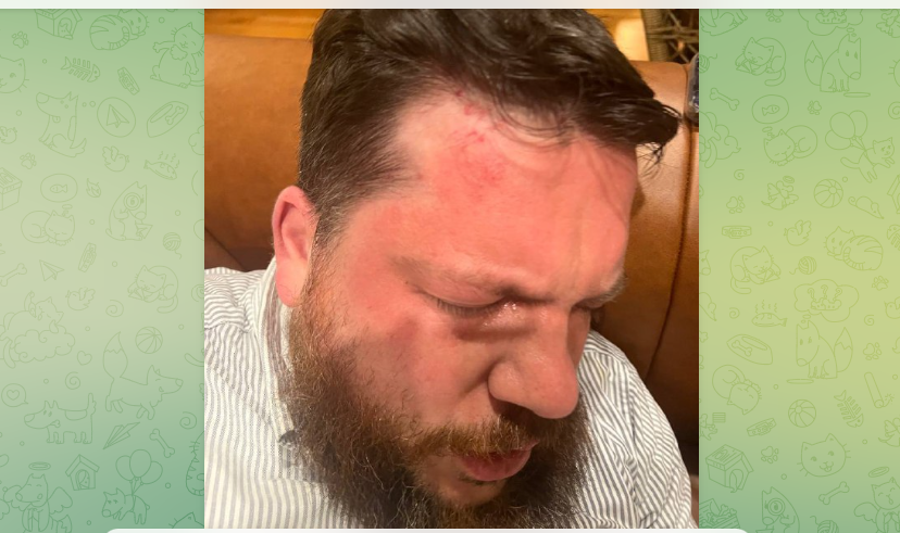 The former head of Alexey Navalny’s Anti-Corruption Foundation was attacked