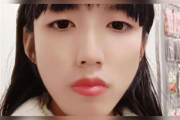 Transgender kadın, elektroşok tedavisinin ardından Çin’de rekor tazminat kazandı