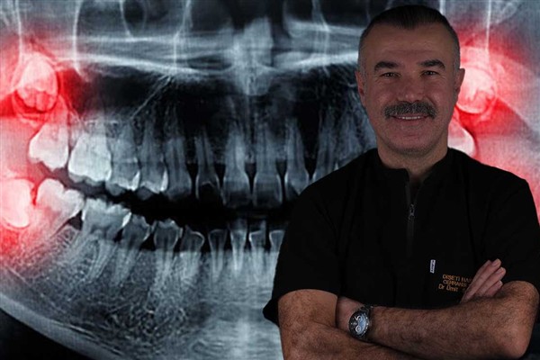 Uzman Diş Hekimi Dr. Yavuz uyardı: Gülüşünüz bozulabilir