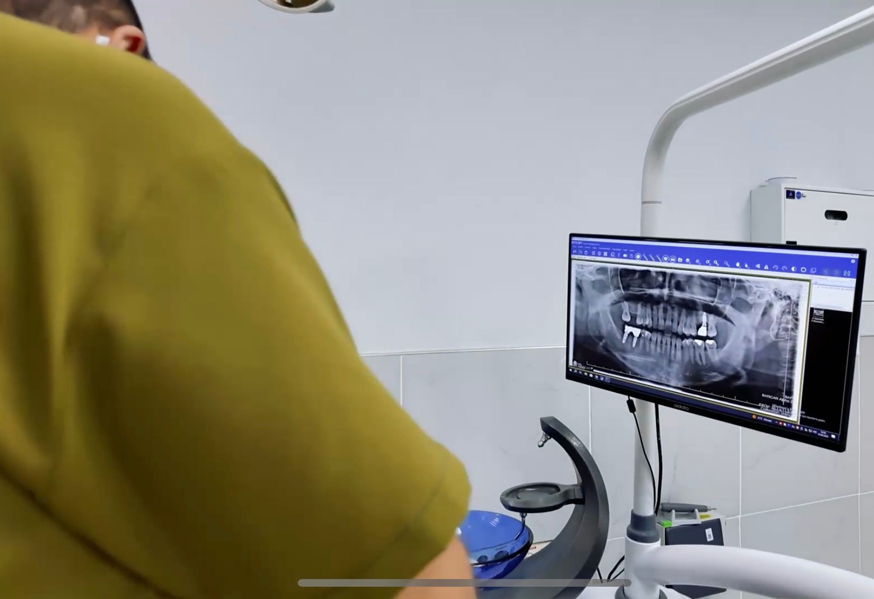 Haliliye Ağız ve Diş Sağlığı Hastanesi’nden 510 bin kişiye tedavi hizmeti