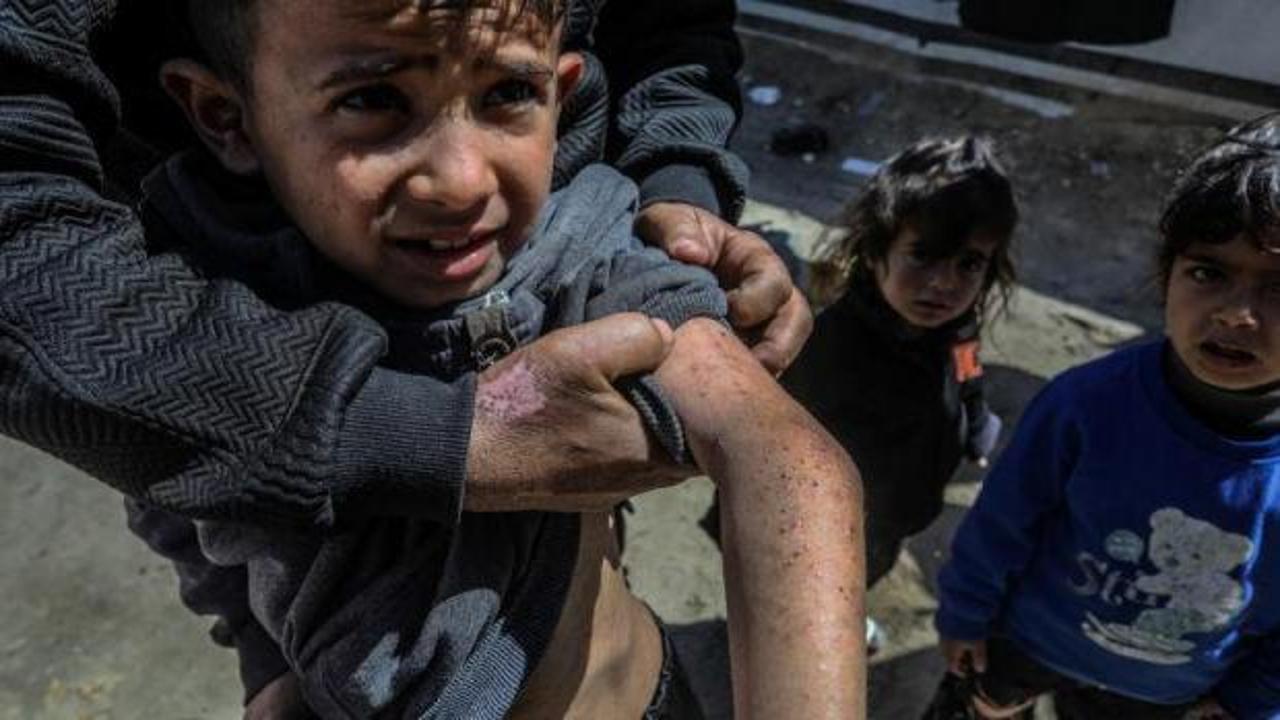 Gazze’de salgın uyarısı: Sağlık bakanlığından DSÖ’ye çağrı